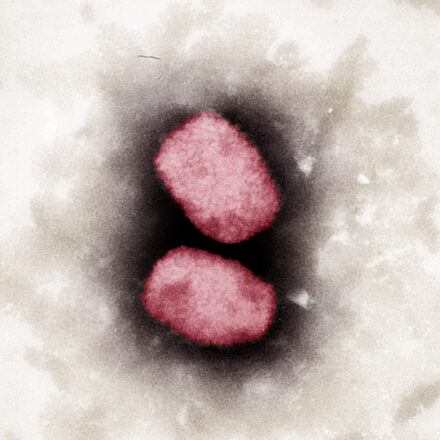 Elektronenmikroskopische Aufnahme von Affenpocken-Viren
